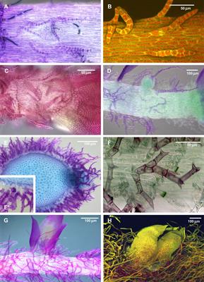 Are All Paraphyllia the Same?